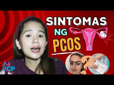 polycystic ovaries tagalog|Sintomas Ng PCOS .